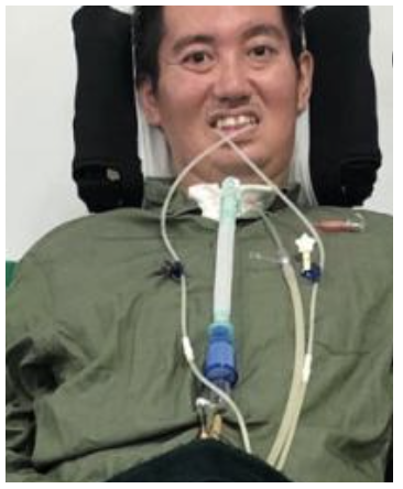 沢木和也の死因はガンで激やせ画像がヤバい！「もう無理」と最後のツイート！