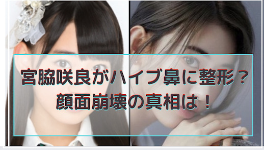 宮脇咲良がハイブ鼻に整形？顔面崩壊を画像比較で検証！