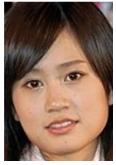 【2022年】前田敦子の顔変わったのは整形でエラを削った？画像比較で検証！
